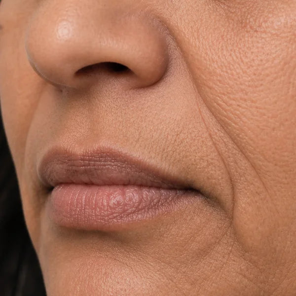 Anti-Wrinkles